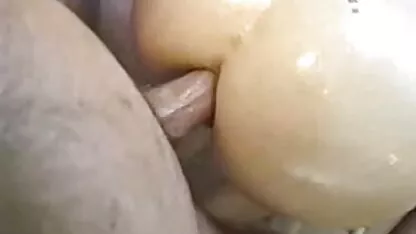 পায়ুসংক্রান্ত স্কার্ট