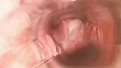 প্রচণ্ড উত্তেজনার সময় ভগ ভিতরে pussy