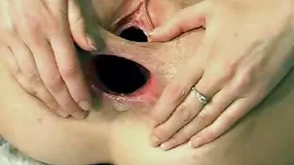 ওয়েবক্যাম গার্ল বিশাল পায়ুসংক্রান্ত এবং prolapse